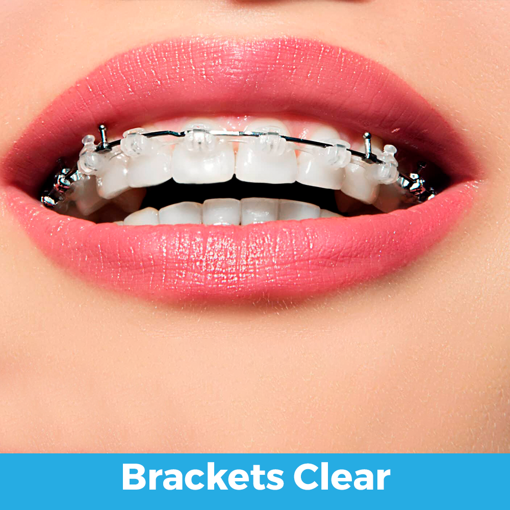 brakets clear
