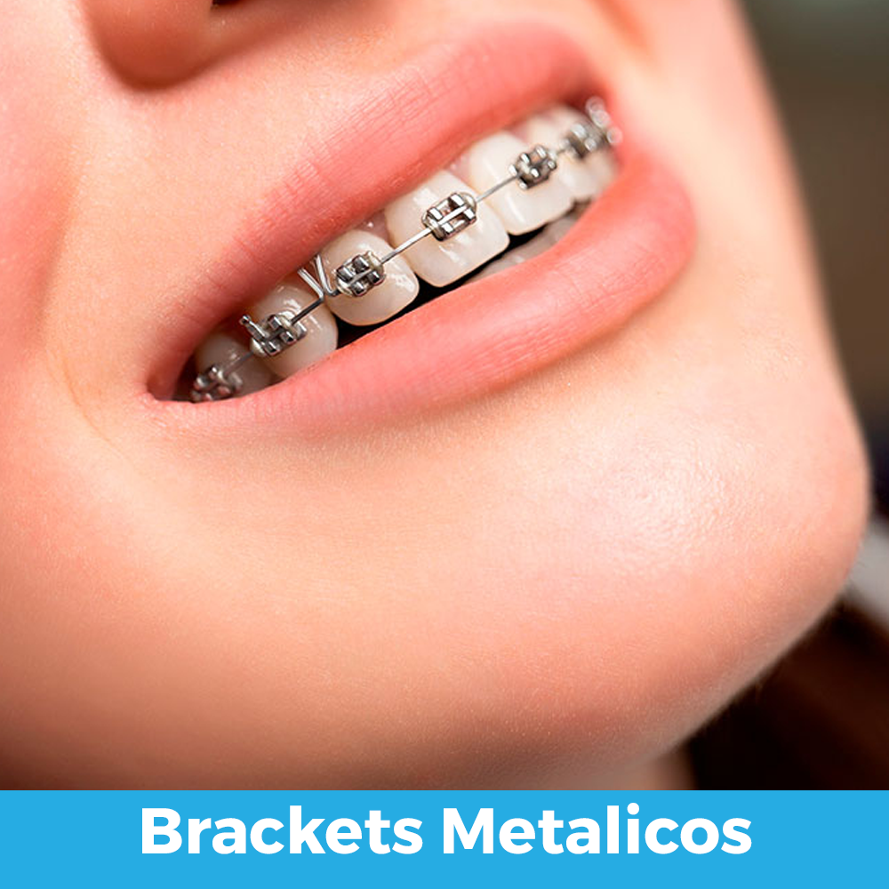 brakets metalicos