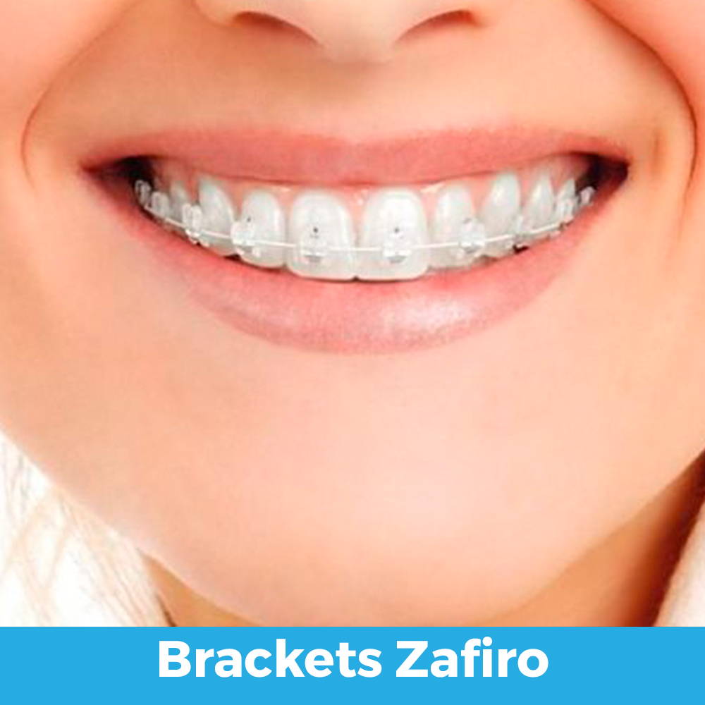 brakets zafiro
