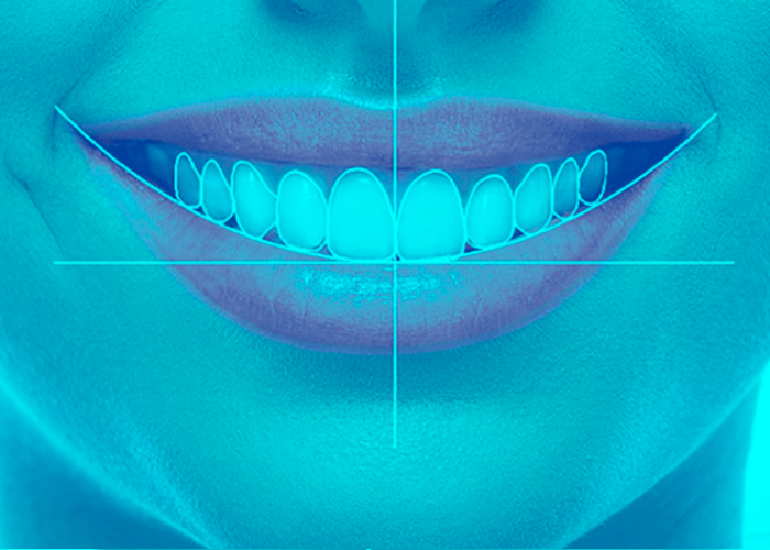 esteticadental03