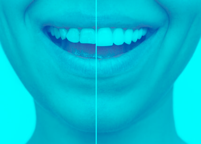 periodoncia02