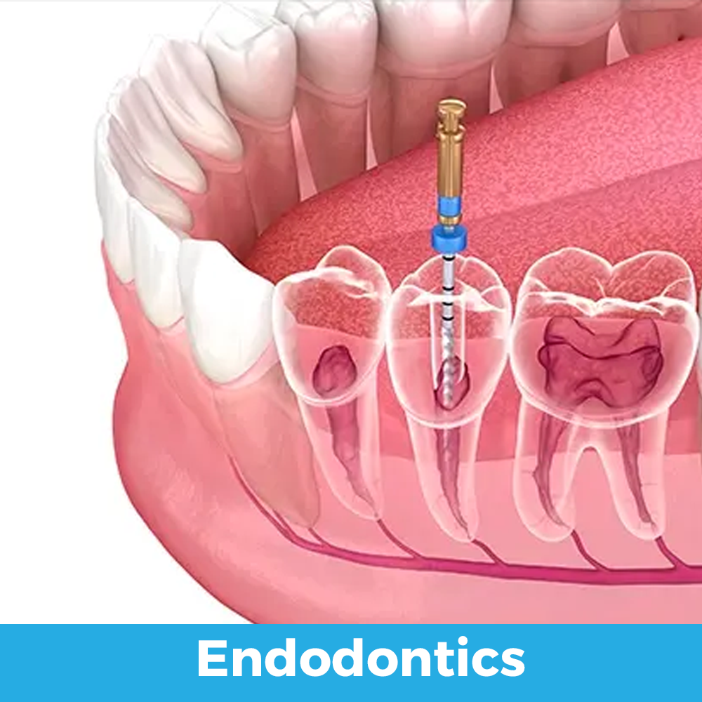 endodontics 01