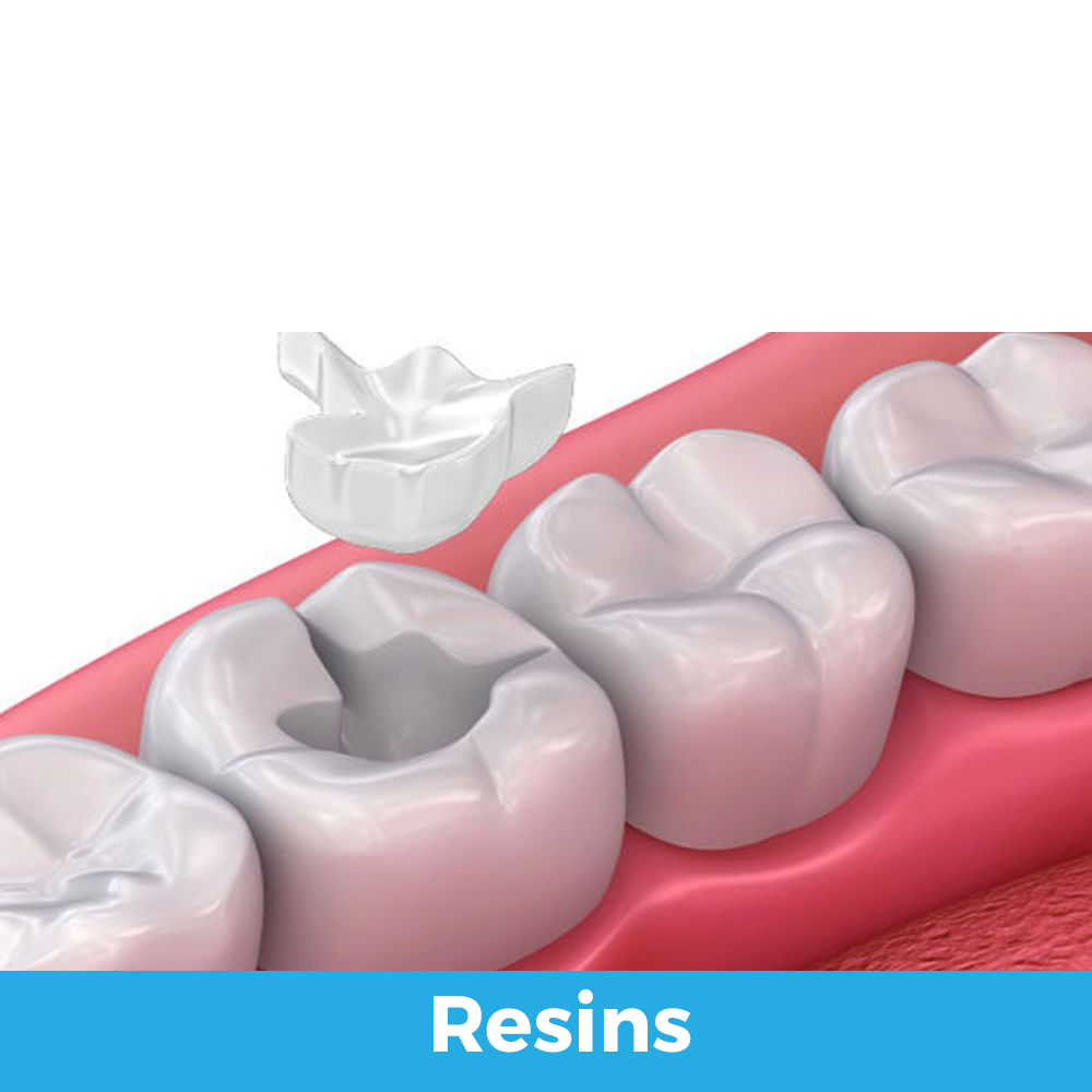 Estética Dental resinas 01 ingles