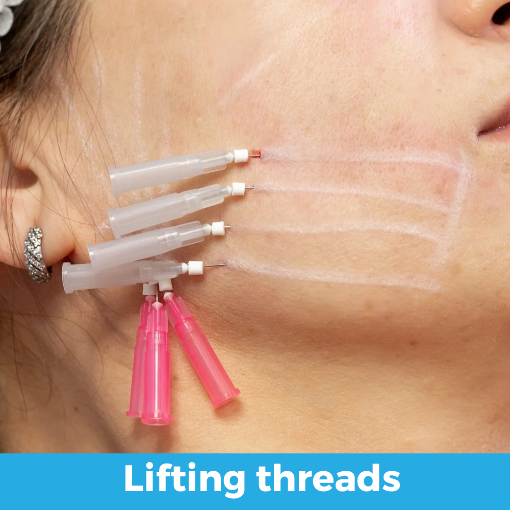lifting threads (collagen biostimulators) v2