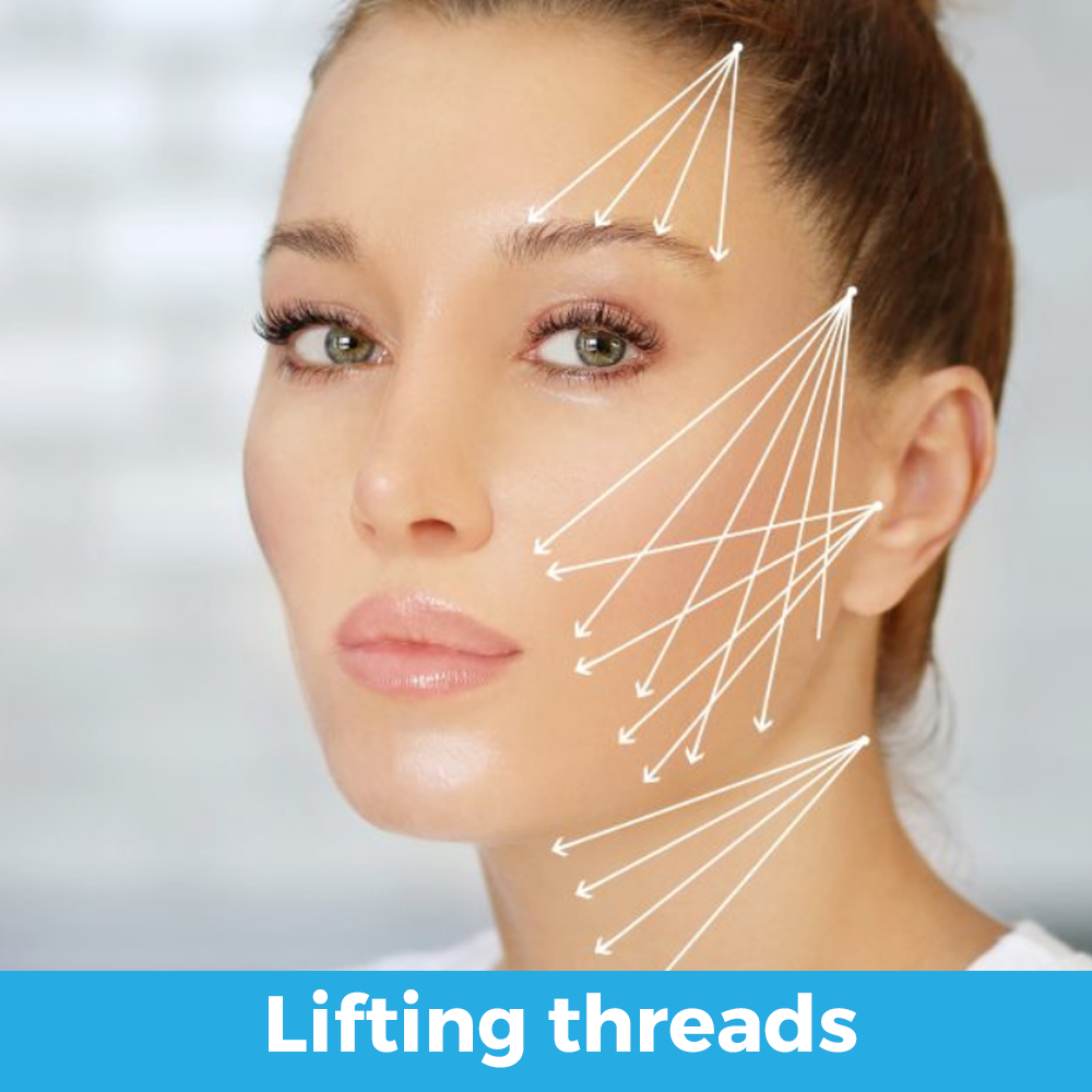 lifting threads (collagen biostimulators)