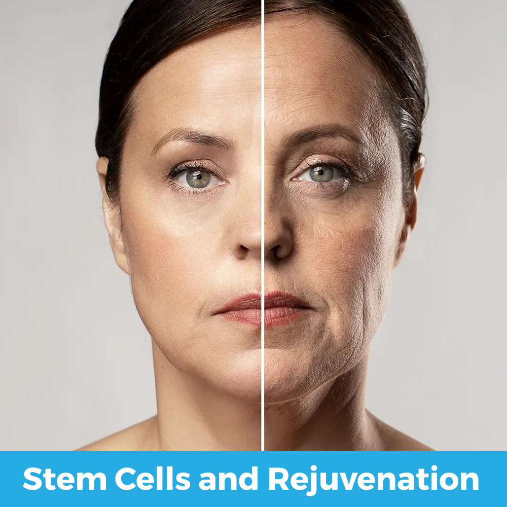 stem cells and rejuvenation v1