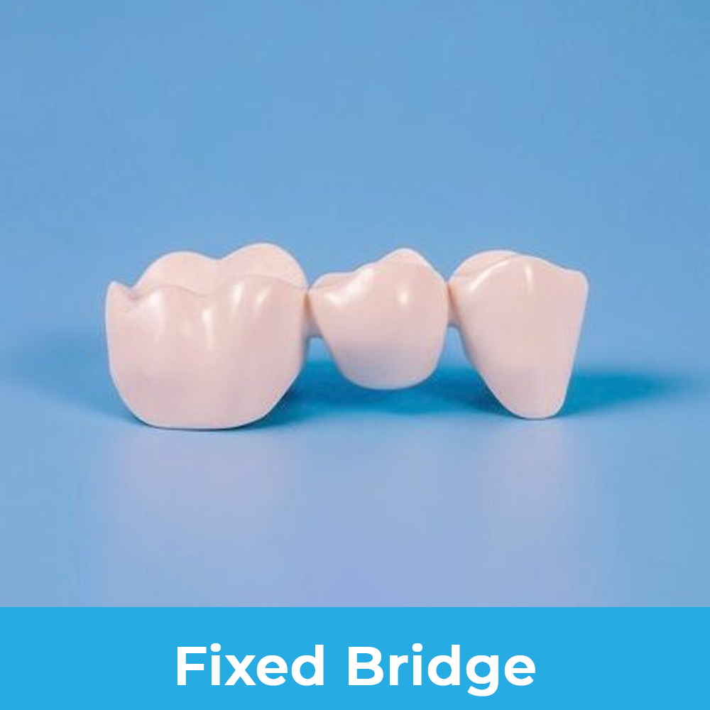Odontología General fixed bridge