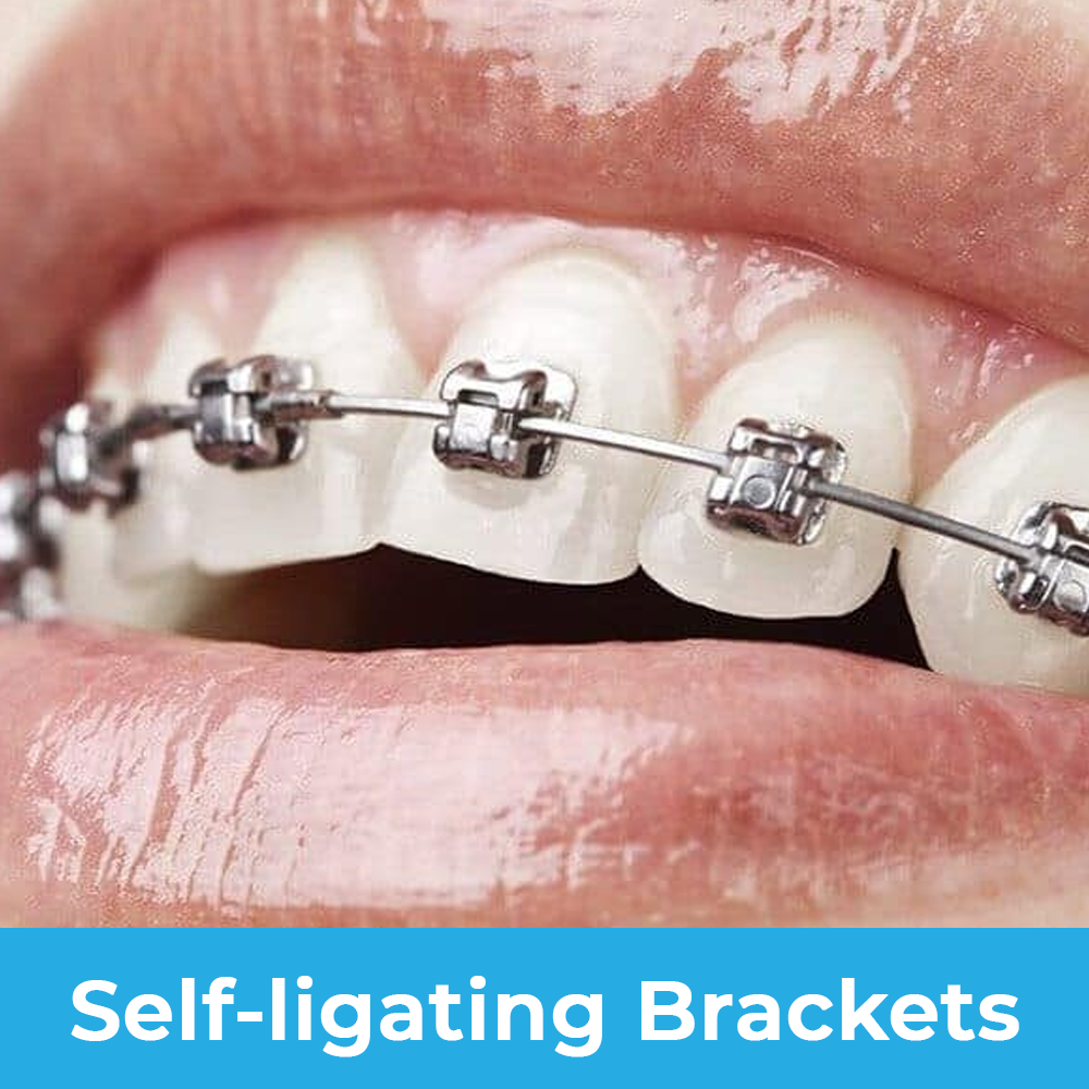 brackets autoligado